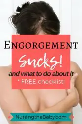 how to ease engorgement