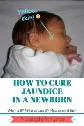 How you can cure jaundice in newborns